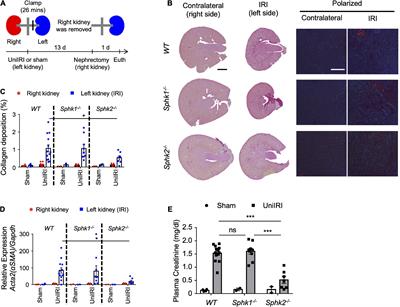 Bone marrow stromal cell antigen-1 (CD157) regulated by sphingosine kinase 2 mediates kidney fibrosis